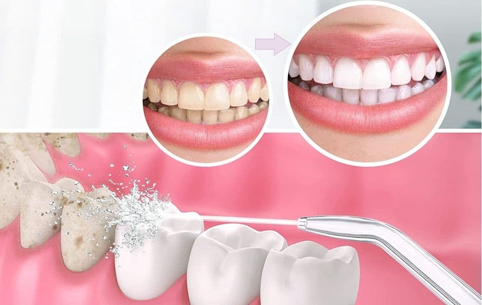 Oralni tuš Dental Yoga — slika 5 od 6